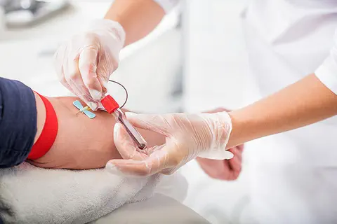 Une simple prise de sang pour dépister le cancer colorectal précoce