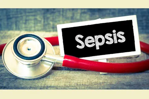 Sepsis : le suivi des recommandations de prise en charge est insuffisant 