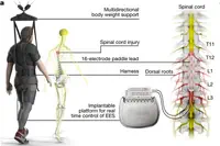 Des patients paralysés retrouvent leur fonction motrice après une stimulation électrique de la moelle épinière