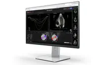 Pie Medical Imaging annonce la sortie mondiale de sa dernière technologie logicielle d’échocardiographie, CAAS Qardia 2.0