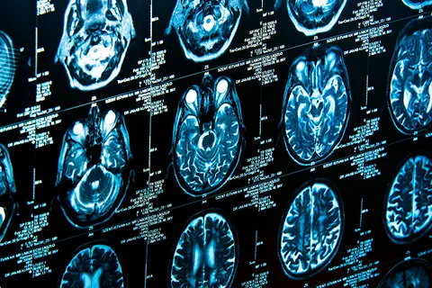 La téléradiologie, une réponse à la crise des urgences en France ?