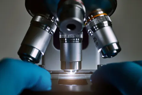 Cancer de la prostate : la découverte de marqueurs urinaires pourrait ouvrir la voie à un diagnostic précoce non invasif