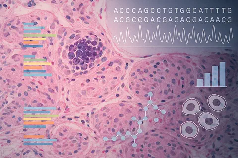 Cure51 et la Charité unissent leurs forces pour analyser les survivants de cancers agressifs