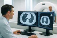 Dépistage du cancer du poumon : l’IPC en éclaireur du pilote national IMPULSION